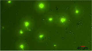lhb_Gfp cells in primary pit culture